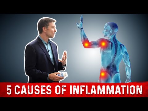 Stop the 5 Causes of Inflammation: FAST!
