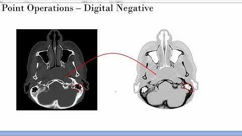 Thresholding, Inversion, and Contrast Stretching on Images