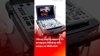 Обзор УЗИ аппарата Mindray M8 - скоро на канале компании @medliga #short #shorts #shortvideo Обзор УЗИ аппарата Mindray M8 - скоро на канале компании @medliga #short #shorts #shortvideo