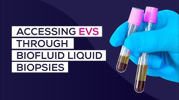 Liquid Biopsies: Access Extracellular Vesicles Through Biofluids