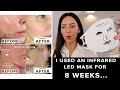 I used the CurrentBody LED Mask for 8 weeks & this happened.