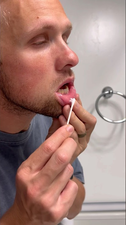 Testing Alum powder to help cure my canker sore! #amazonfinds #alumpowder #cankersores #amazon