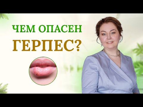 Чем опасен герпес?Чем