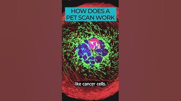 PET Scans: An advanced imaging tool for detecting cancer 🎗️🔍