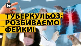 Як не повестися на фейк: що треба знати українцям про туберкульоз?