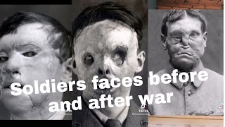 Soldiers faces before and after war😳
