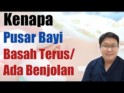 Video: 3 Cara Mengobati Infeksi di Pusar Anda