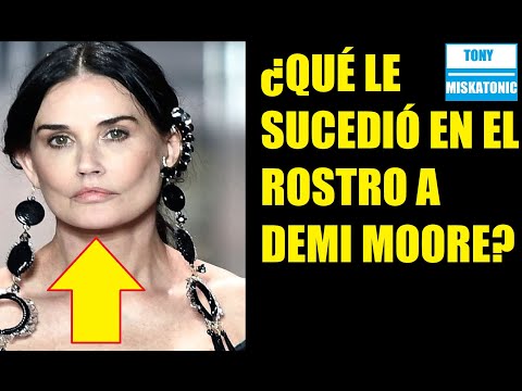 Video: Si Demi Moore Ay Hindi Kinilala Pagkatapos Ng Plastic Surgery