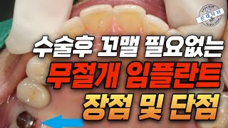 무절개 임플란트 최소절개 임플란트 플랩리스 임플란트 수술법의 장점 및 단점 적응증 flapless implant surgery #임플란트 #임플란트수술 #치과