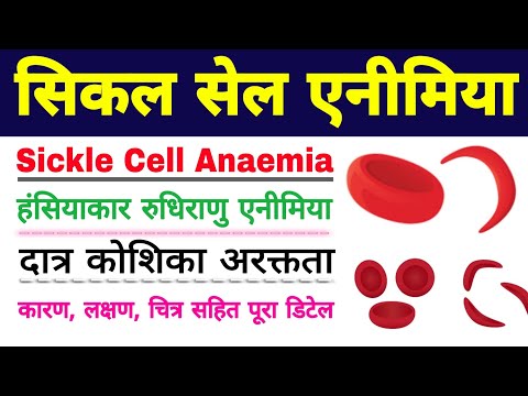 सिकल सेल एनीमिया | sickle cell anemia in hindi | sickle cell anemia class 12 biology ScienceSK