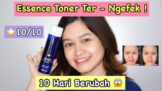 ESSENCE TONER INI BERHASIL MERUBAH KULIT WAJAH DALAM 10 HARI ! | AIZEN DERMALOGY HYORIN INFUSION