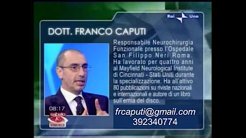 Cos'è la mielopatia cervicale?