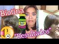 BIOTINA ( Resultados), Historia de mi transición /-Lismi Rodríguez 💜