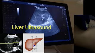 How to scan the Liver Dr.Ismail Sayed Ismail