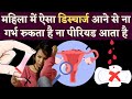 ऐसा डिस्चार्ज होना प्रेगनेंसी का सबसे पक्का लक्षण है| White discharge in women | pregnancy symptoms