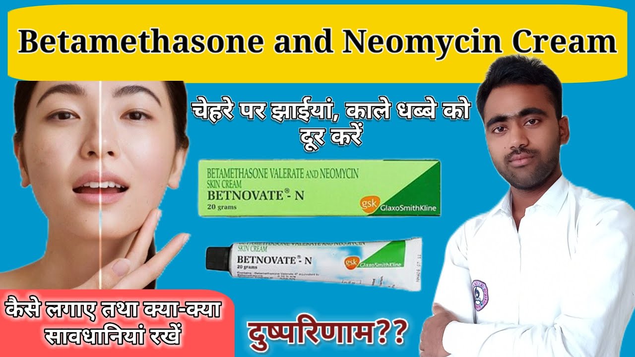 Betnovate n cream | betamethasone, neomycin cream | चेहरे के धब्बे कैसे दूर करें?