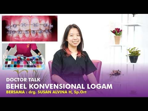 Video: Langkan logam: keuntungan dan rekomendasi pemasangan