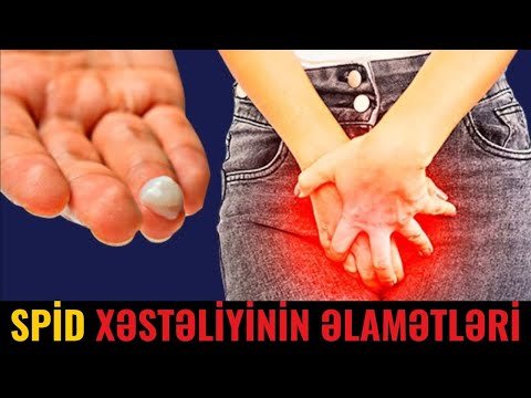 CİNSİ YOLLA yoluxan Ölümcül xəstəlik - HİV(QİÇS,  SPİD)