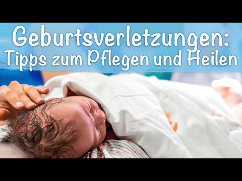 Video: Sitzbad Nach Der Geburt: Was Sie Nach Der Geburt Wissen Möchten