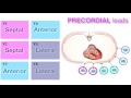 Ischemia 37  localization on ecg