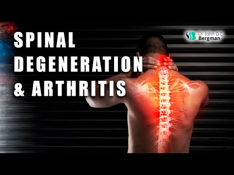 Spinal Degeneration & Arthritis