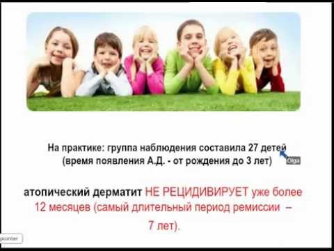 Нейродермит у детей и взрослых Нейродермит у детей и взрослых