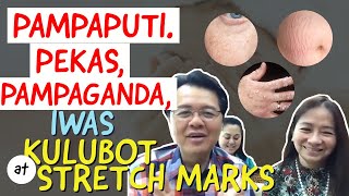 Pampaputi, Pekas, Pampaganda. Iwas Kulubot at Stretch Marks at Labi - Payo ni Doc Willie Ong #187