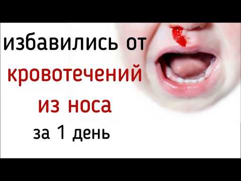Кровь из носа у ребенка больше не течет. Помог простой совет Юрия Андреевича Фролова.