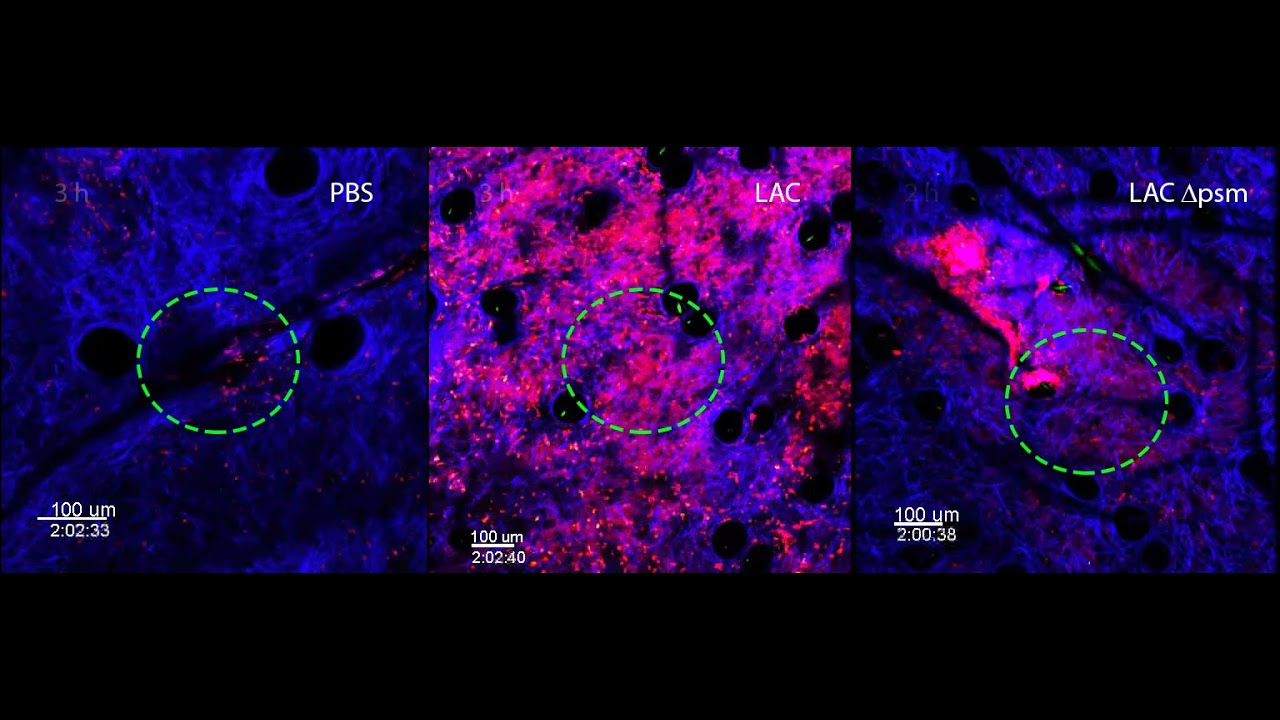 Rapid pathogen-specific recruitment of immune effector cells in the skin by secreted toxins - 1