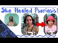 Juicecast ep001 sudeshna heals psoriasis