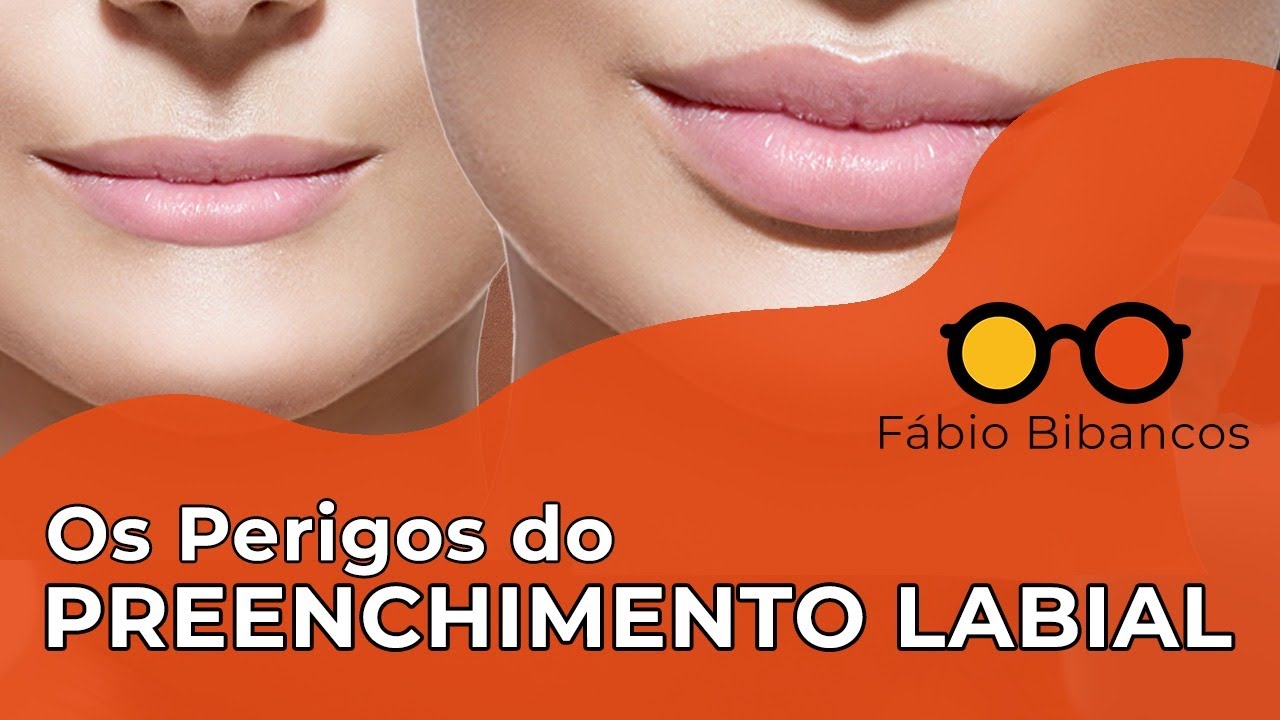 Não Faça Preenchimento Labial Sem Ver Esse Vídeo!