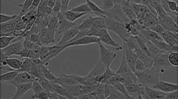 NanoEnTek_NIH-3T3 cell growth_20 hrs_zoom level_16X