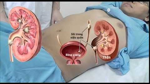 Kỹ năng khám hệ thống thận tiết niệu   YouTube