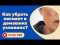 ПИГМЕНТАЦИЯ / Как убрать пигмент в домашних условиях? / КОНКУРС