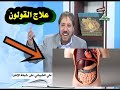 علاج القولون للدكتور ابو علي الشيباني 