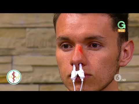 Vídeo: Tratamiento De La Sinusitis Con Ciclamen