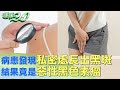 病患發現私密處長出黑斑 結果竟是惡性黑色素瘤 健康2.0 @tvbshealth20