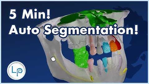 $19! $5 Minutes! Completely Automatic CT to STL Segmentation! (CC)