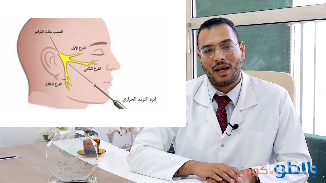 علاج العصب الخامس | التردد الحراري | د.احمد الشال
