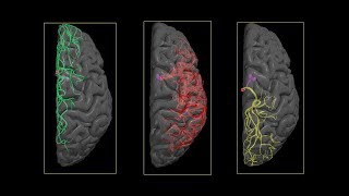 MRI chuỗi xung và giải phẫu MRI sọ não, Bs Phan Châu Hà