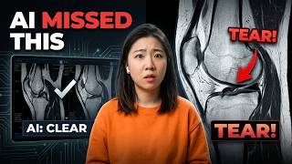 Doctor vs AI: Who Actually Reads MRI Scans Right?