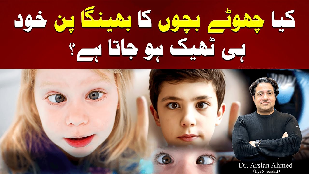 Does Squint in Children Go Away on Its Own? Complete Treatment Guide Urdu/Hindi