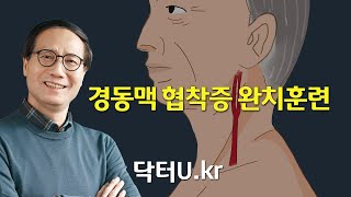 목 혈관 두께 , 경동맥 초음파 , 경동맥 스텐트보다 먼저 해야 하는 것  : 닥터U의  경동맥 협착증 완치훈련 