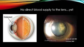 Use Of BEMER Technology in Vision Health with Dr Todd Wylie,OD