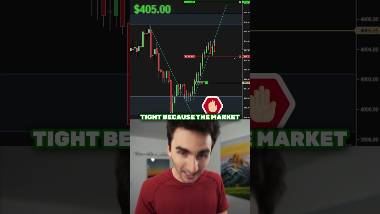 You Need a Trading Management Strategy You Need a Trading Management Strategy