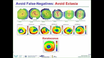 AECOS 2016 presentation by Dan Reinstein on the ArcScan Insight 100