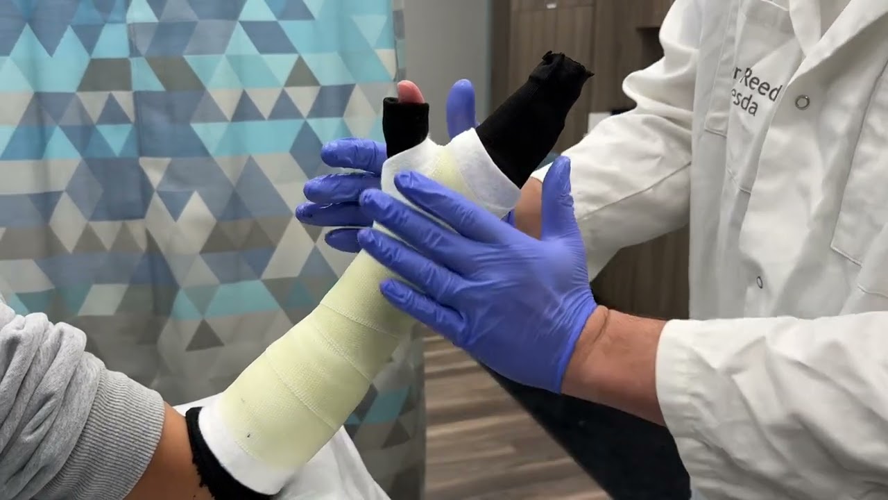 Короткая рукоятка (стекловолокно)