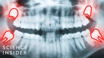 6 Ways Evolution Screwed Us Over