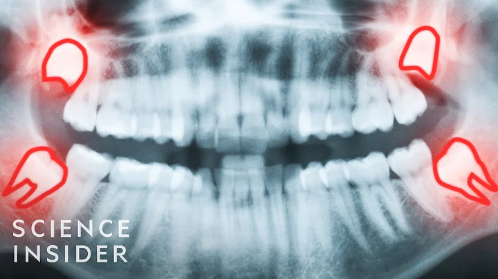 6 Ways Evolution Screwed Us Over