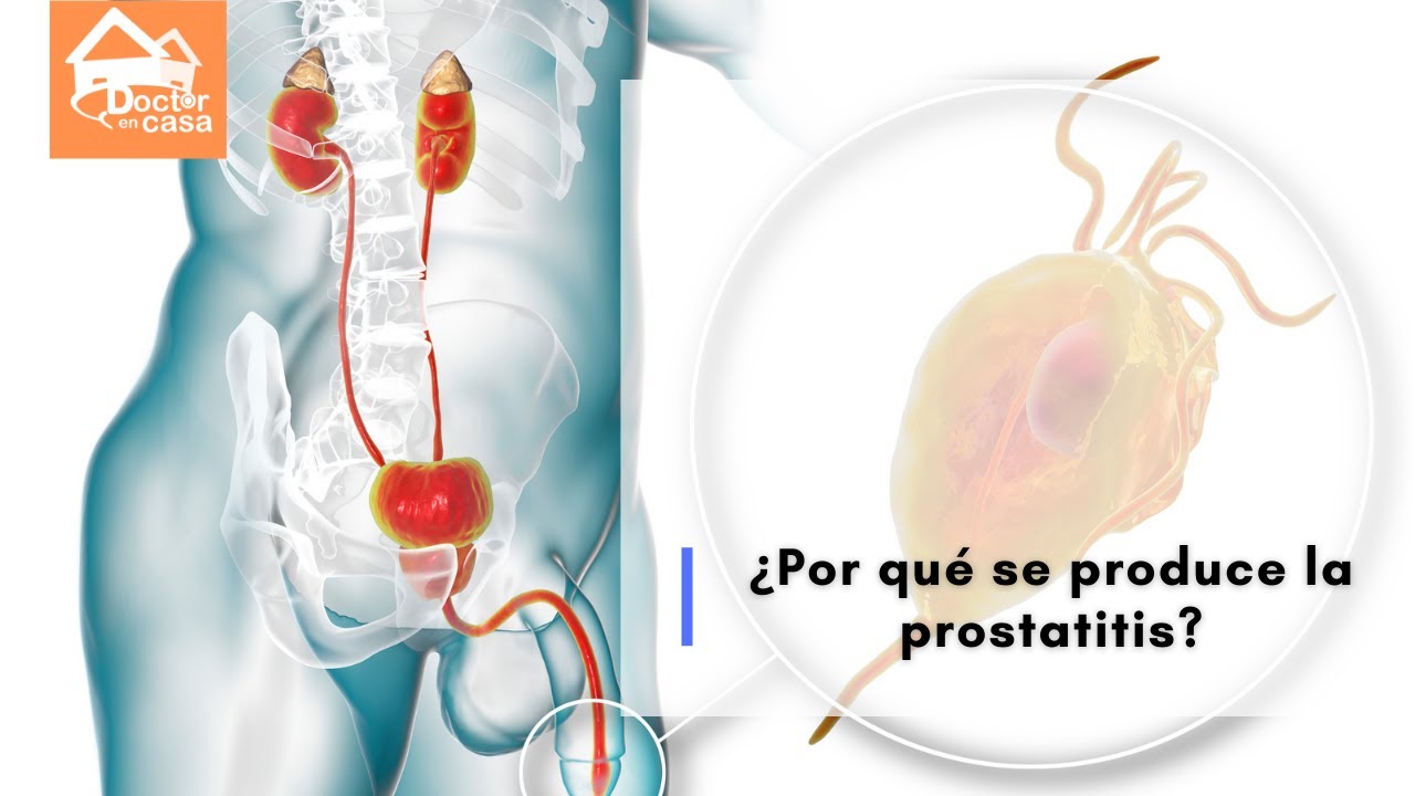 Qué antiinflamatorio es bueno para la prostatitis